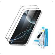 Anker Easy Fit HD Vergleich