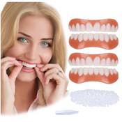 Eondevo Veneers Vergleich