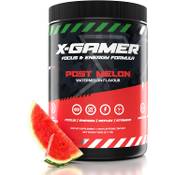 X-Gamer X-Tubz  Vergleich