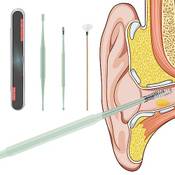 Hmycl Ohrenschmalz Entferner