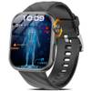 Marsyu Smartwatch
