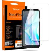 Spigen OnePlus 8 Pro  Vergleich