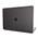 Peterong MBP