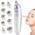 Topdirect Mikrodermabrasion Maschine
