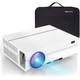 Topvision TP-98 Vergleich