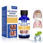 Toulifly Nagelreparatur Öl