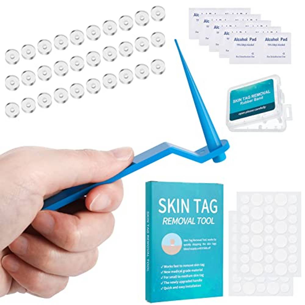 Scomb Stielwarzen-Entferner: Top 10 Test & Vergleich
