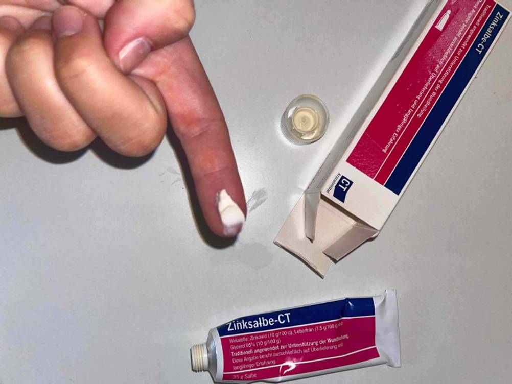 Zinksalbe auf Finger aufgetragen - Verpackung und Tube zu sehen.