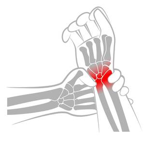 Das Handgelenk ist täglich Verletzungen oder Überreizungen ausgesetzt.