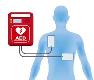 externer defibrillator