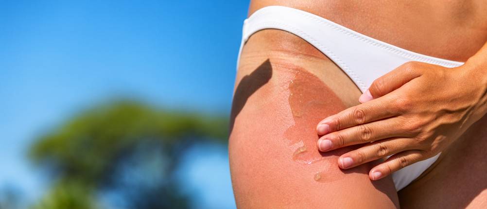after-sun-aloe-vera-test