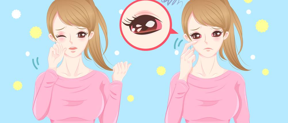 Allergie-Augentropfen-Test