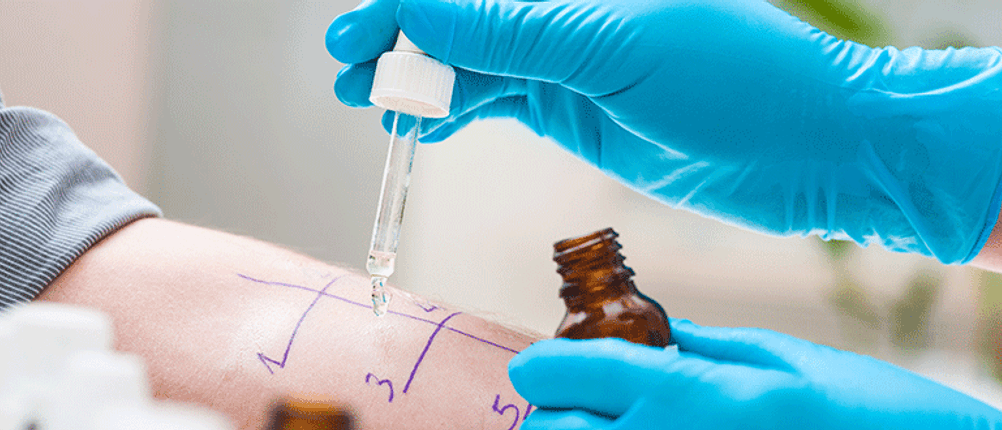 allergietest heuschnupfen