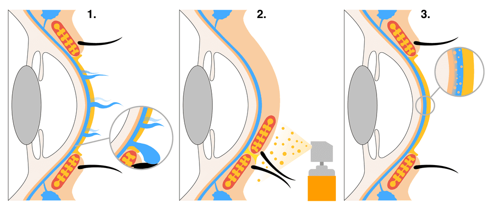 liposomales augenspray