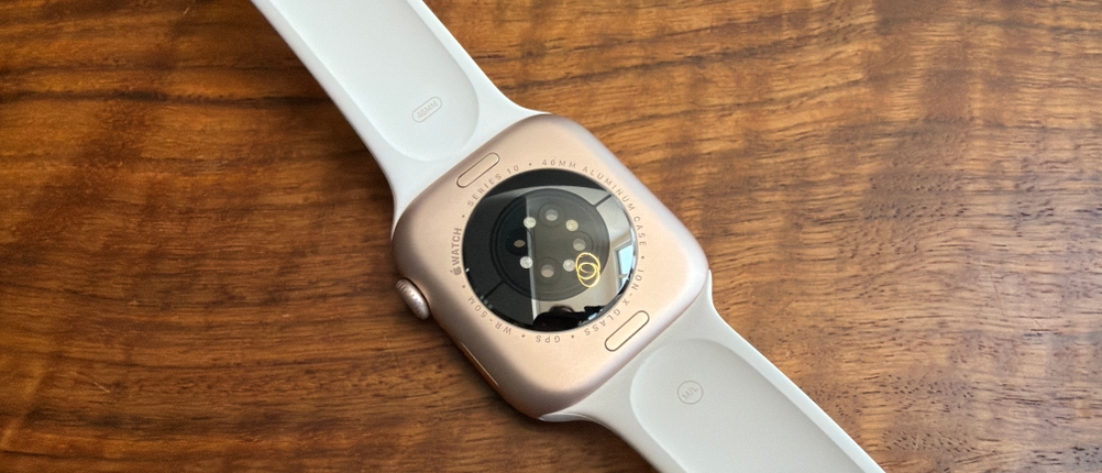 Die Unterseite der Apple Watch Series 10