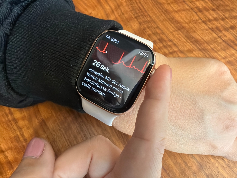 Die Apple Watch Series 10 macht ein EKG