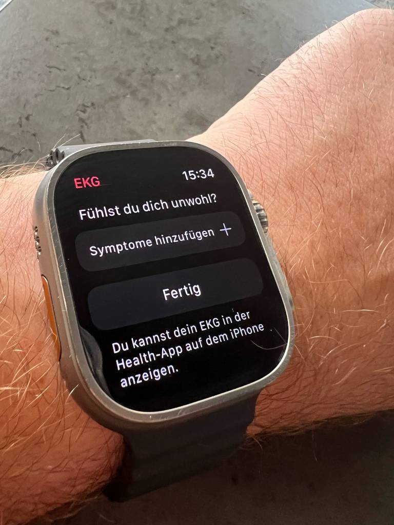 Smartwatch-EKG-Test: Die Watch am Handgelenk zeigt die Frage nach dem Wohlbefinden an.