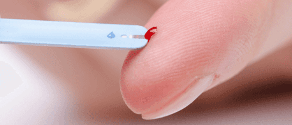 Blutzuckermessgerät Test Finger Blut