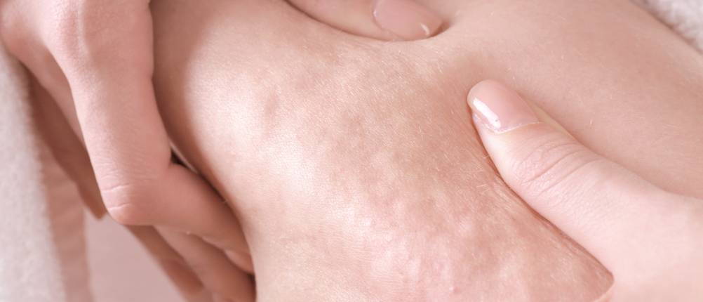 Cellulite-Vakuum-Saugmassagegerät