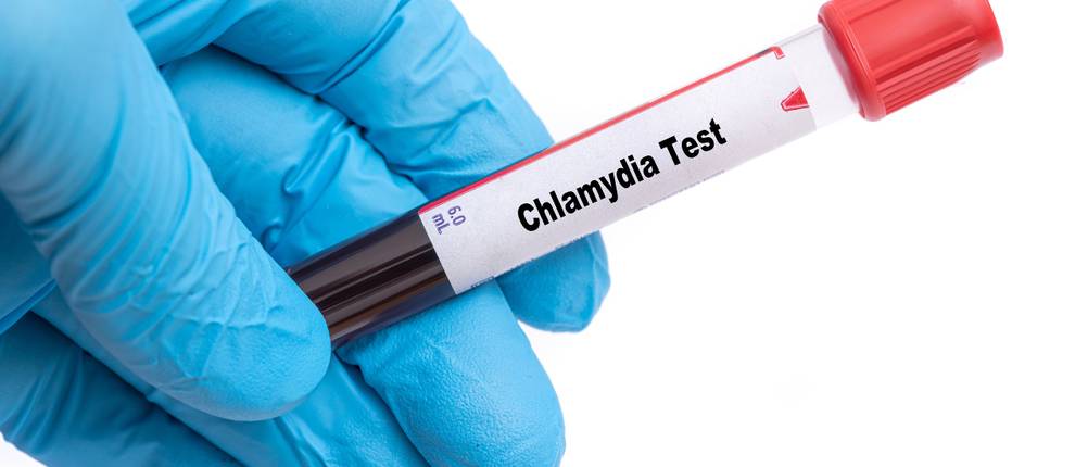 chlamydientest-test