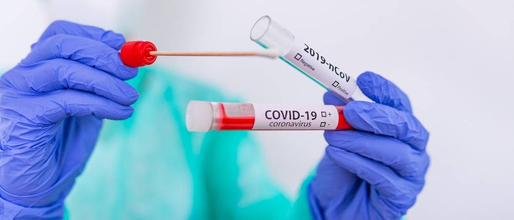 Coronavirus-Schnelltest-Test