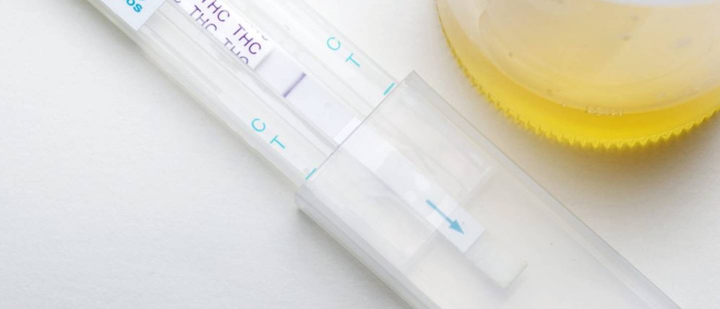 Drogentest THC Test & Vergleich » Top 12 im August 2024