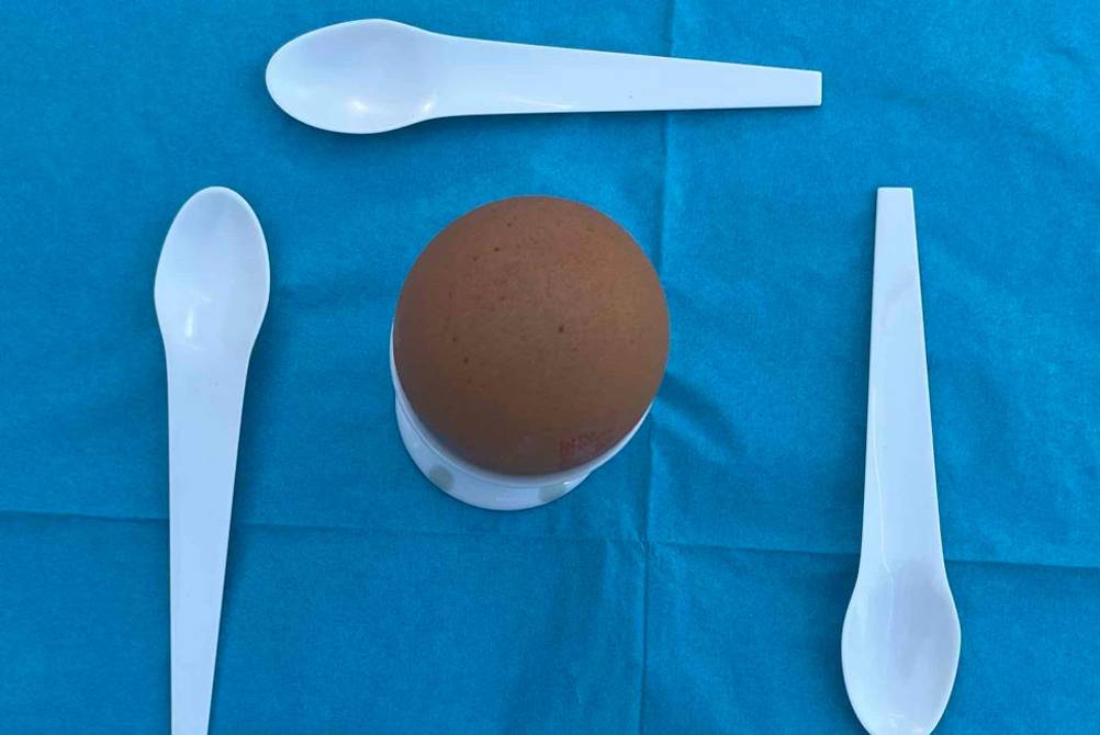 Im Test: vier weiße Eierlöffel liegen im Quadrat um ein Ei im Eierbecher.