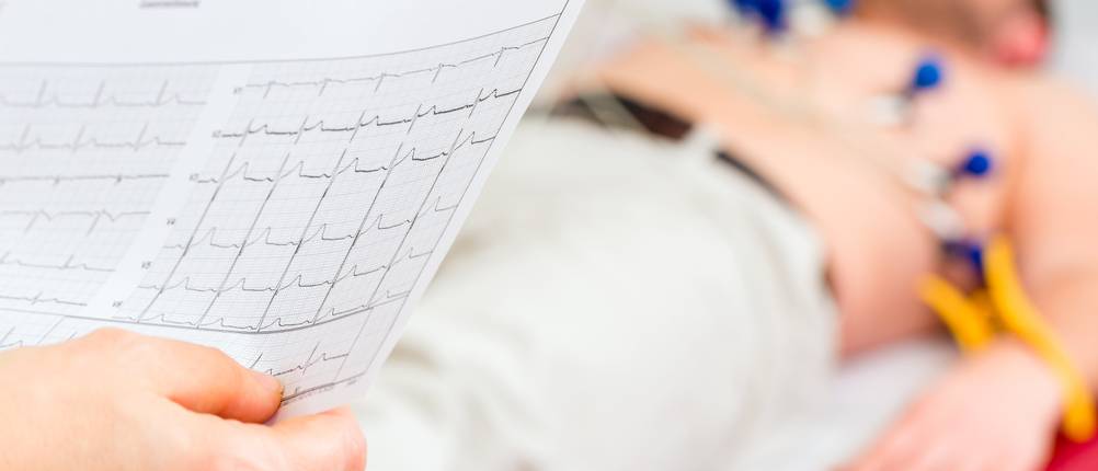 mobiles ekg-gerät test