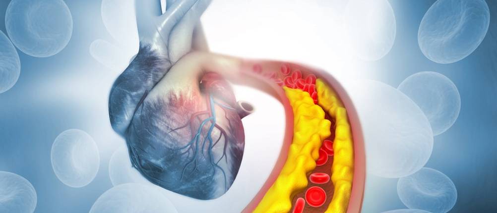 blut cholesterin fettbinder