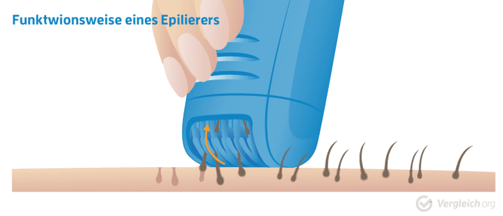 Funktionsweise Epilierer