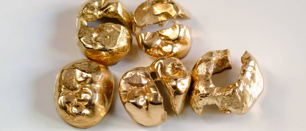 Mehrere Zahnkronen aus Gold liegen auf einer weißen Oberfläche.