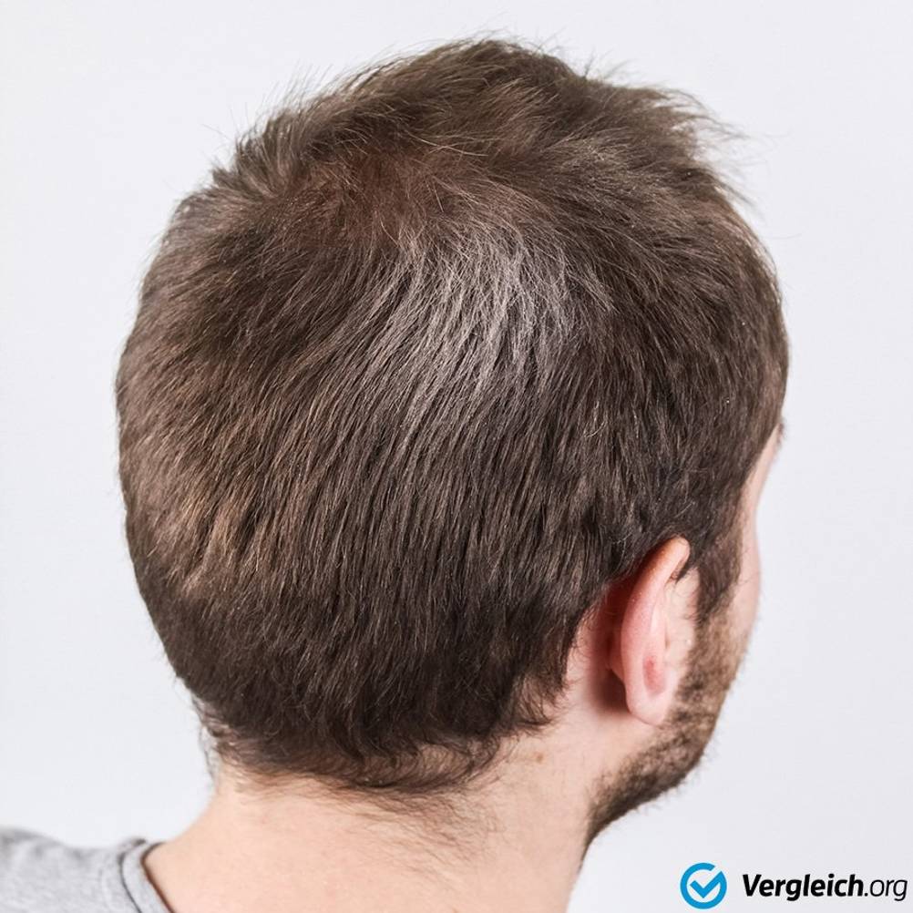 rückstände im haar
