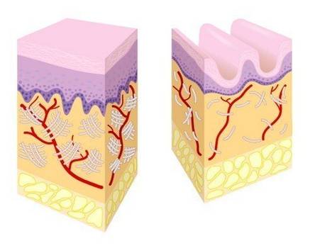 junge und alte Haut im Vergleich