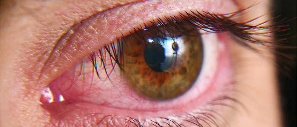 Hyaluron-Augentropfen-Test