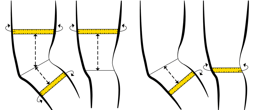 kniebandage abmessen