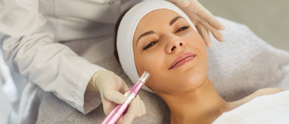 Microneedling-Pen im Test: Frau wird mit Dermapen behandelt.