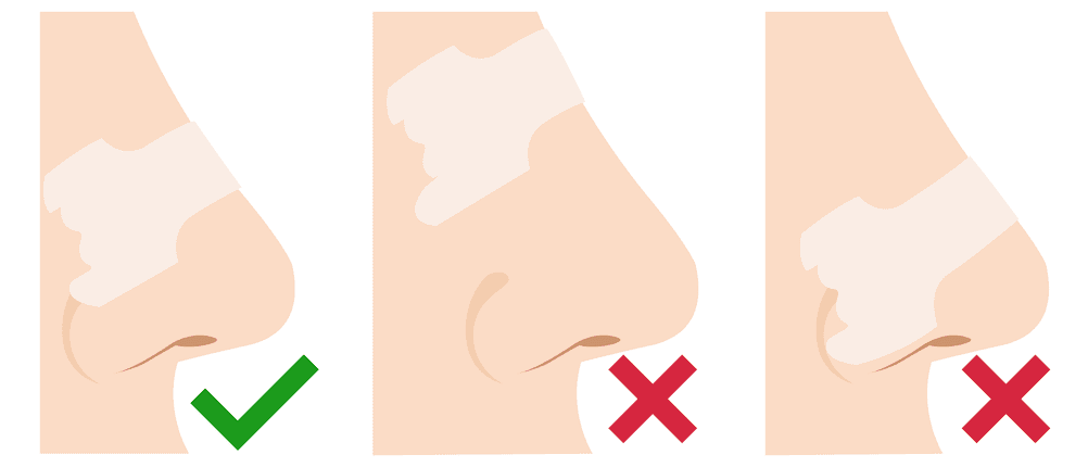 Nasenpflaster Position