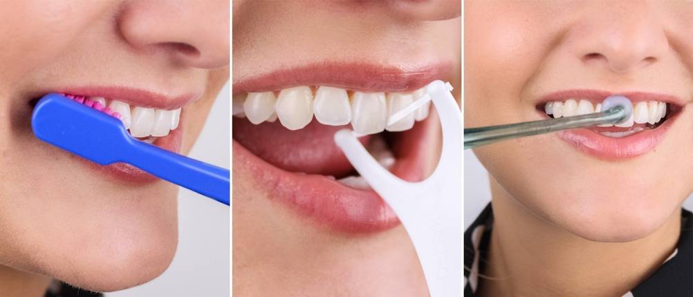 Zahnpflege Tipps