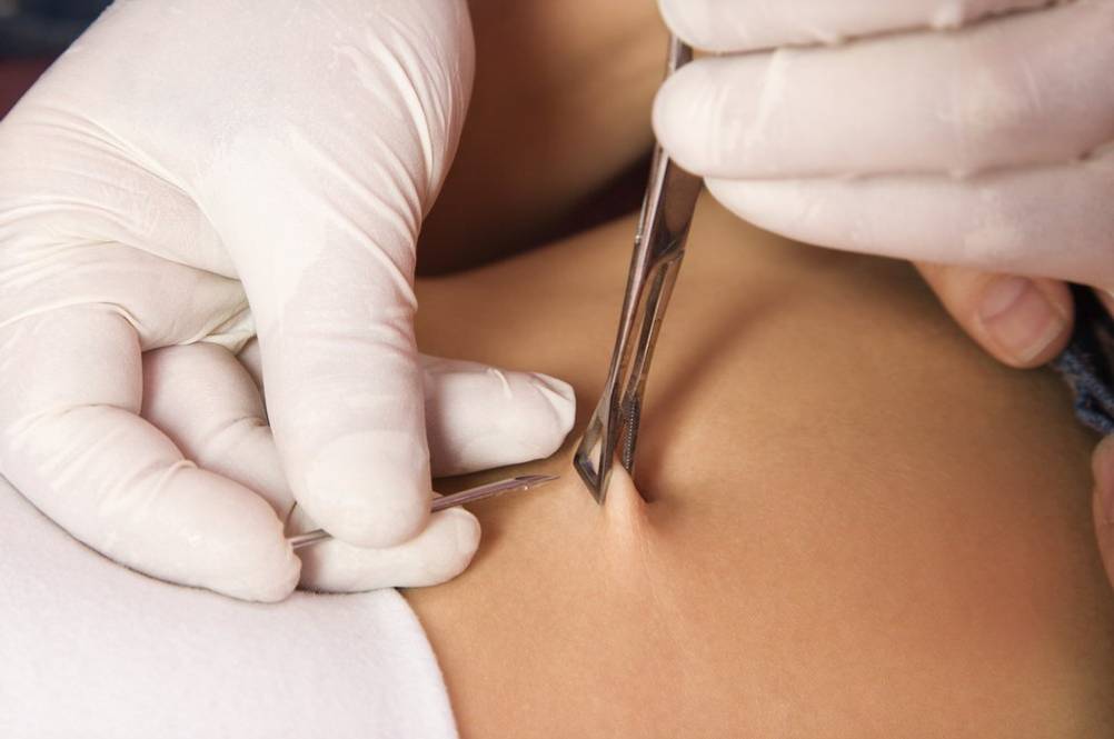 piercing-am-bauchnabel