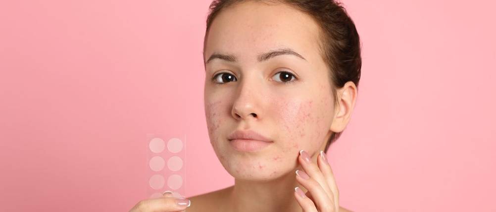 Pimple Patch Test