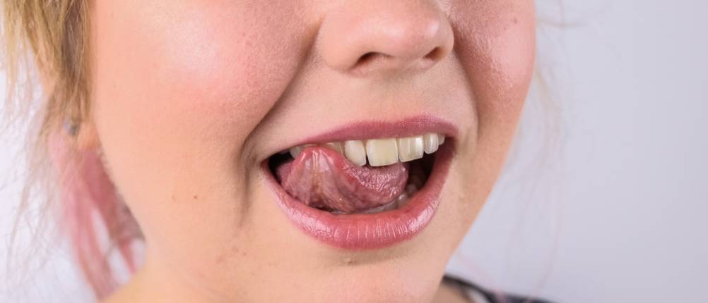 Reinigungsleistung