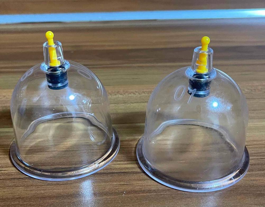 Zwei Schröpfgläser stehen zum testen nebeneinander auf einer dunklen Holzfläche.