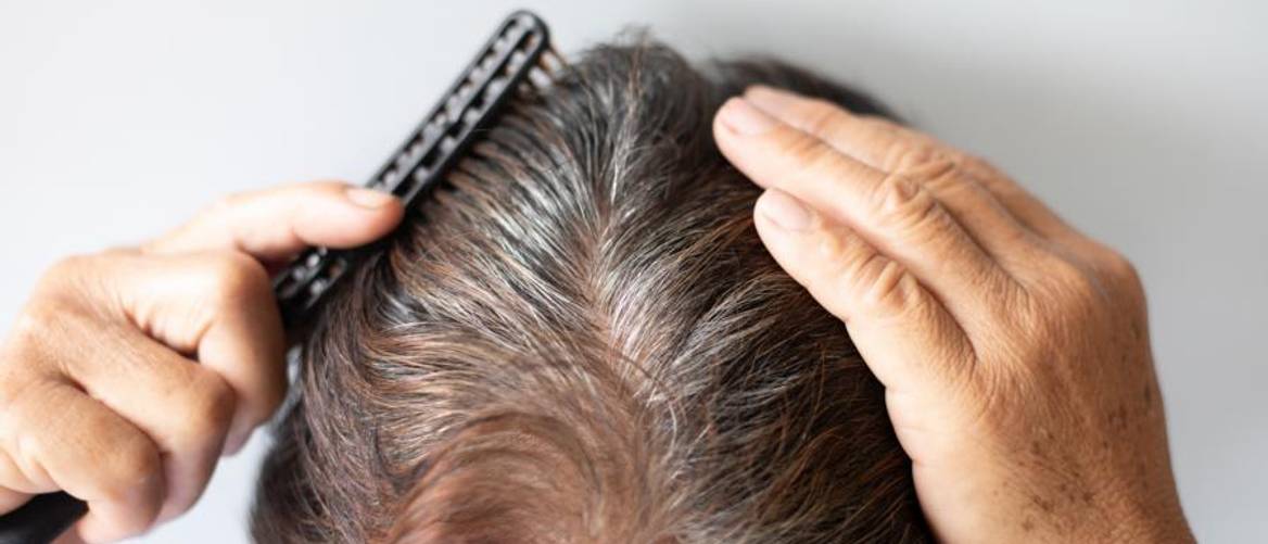 Schne Shampoo Fr Graue Haare Test Ebenbild