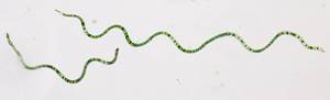 spirulina-alge-unter-mikroscop