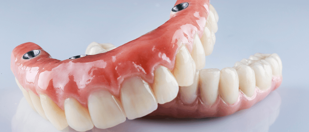 Getesteter Ultraschallreiniger für Zahnprothese: Zwei Zahnprothesen liegen übereinander.