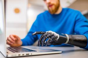 Test der Unfallversicherungen: Ein Mann sitzt mit einer Armprothese an einem Laptop.