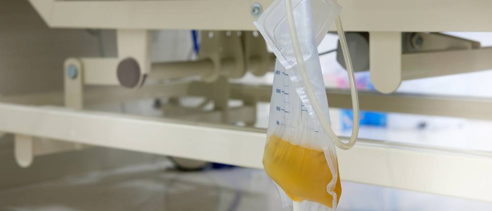 urinbeutel-test