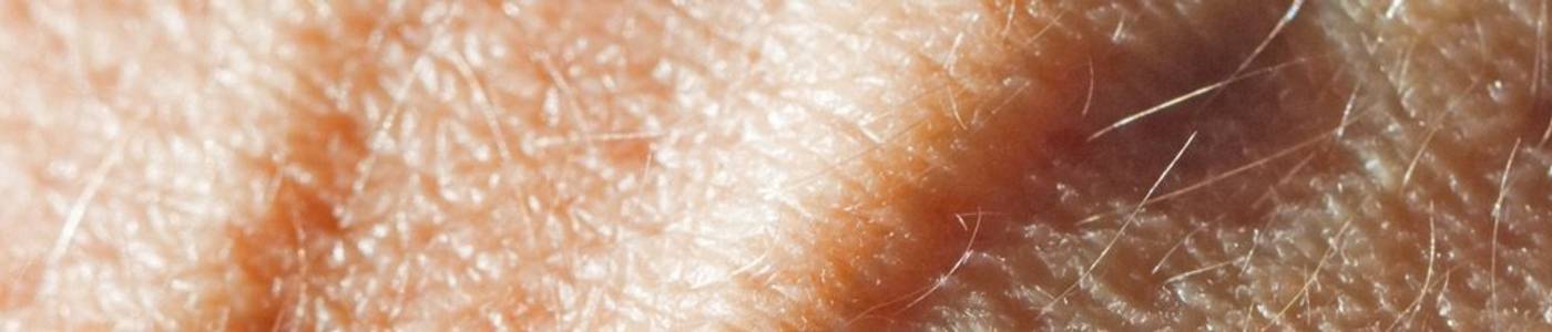 Tests & Vergleiche aus der Kategorie Venengesundheit