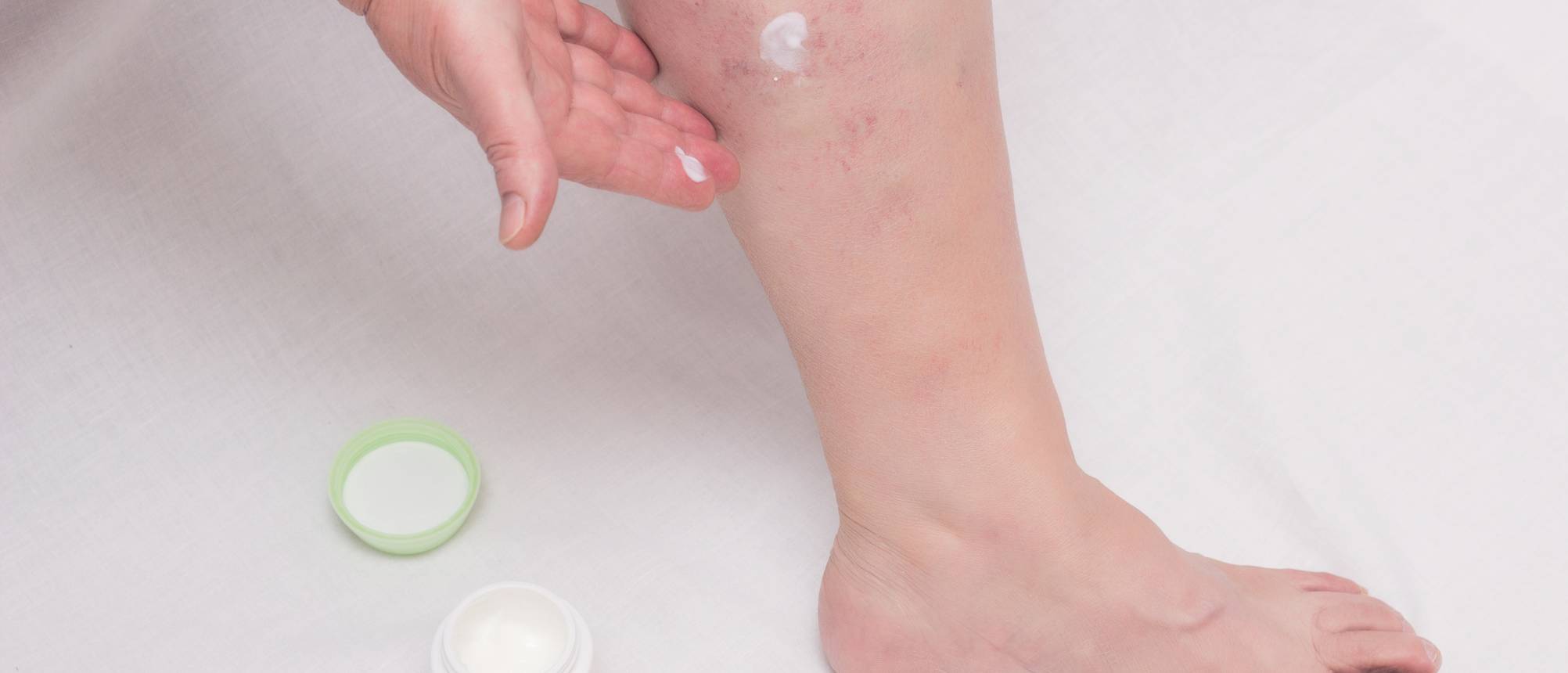 Venensalbe Test & Vergleich » Top 23 im August 2025