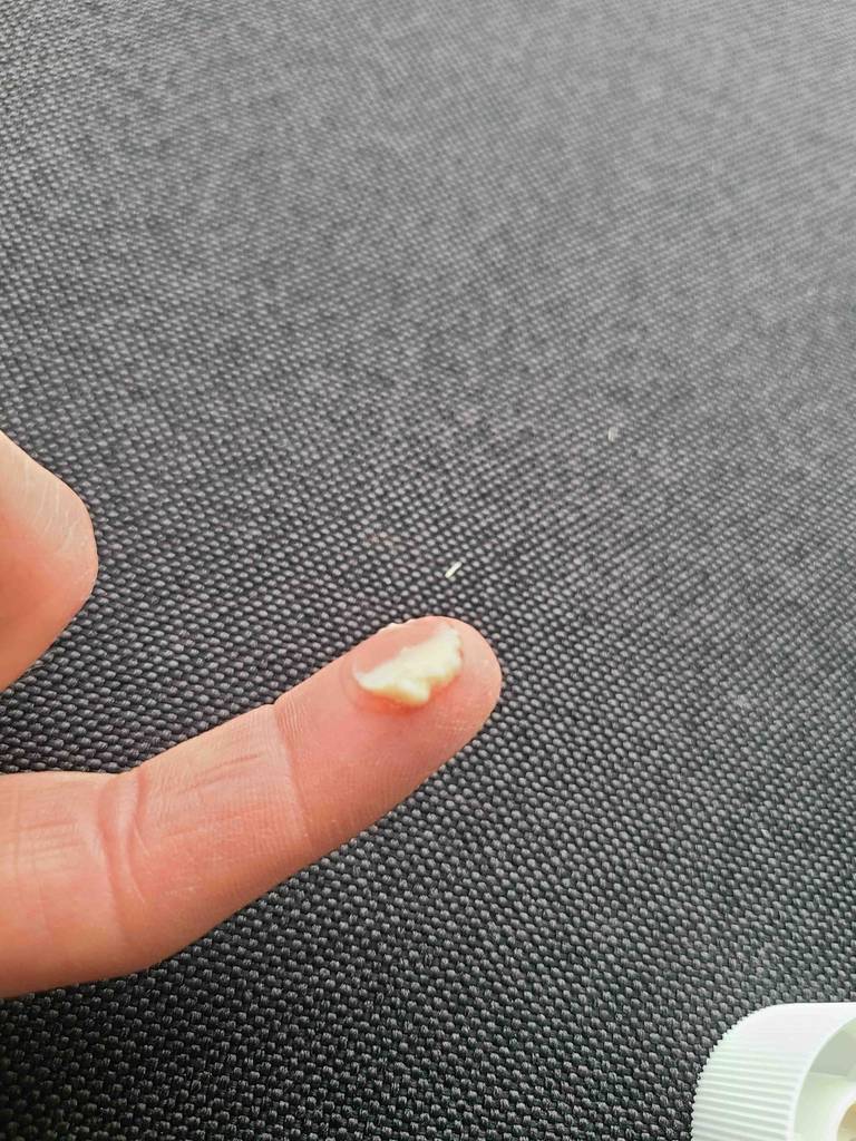 Wärmesalben-Test: Ein Finger hat etwas beigefarbene Creme auf seiner Spitze.